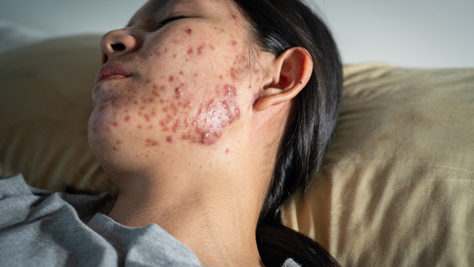 5-Ancaman-Lembap-pada-Kulit-yang-Wajib-Diwaspadai